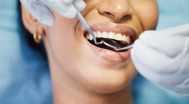 Best Emergency Dental Care for Sports Injuries in Middlesborough, KY