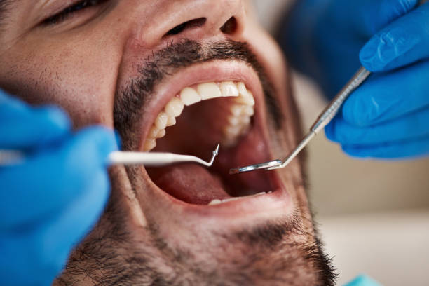 Best Broken or Chipped Tooth Repair in Middlesborough, KY